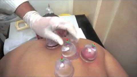 comment devenir hijama